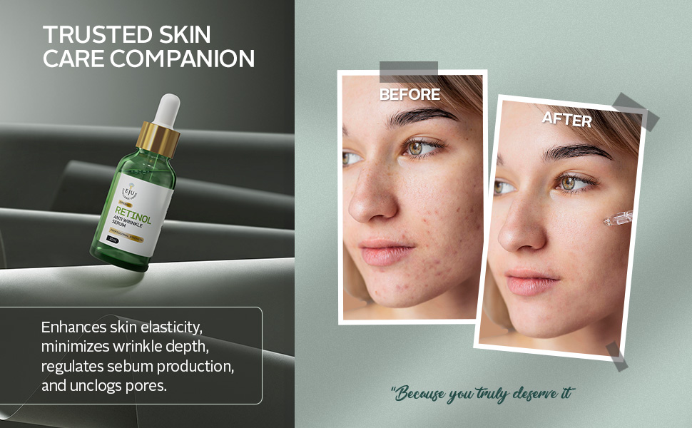 Retinol_A+Content_04